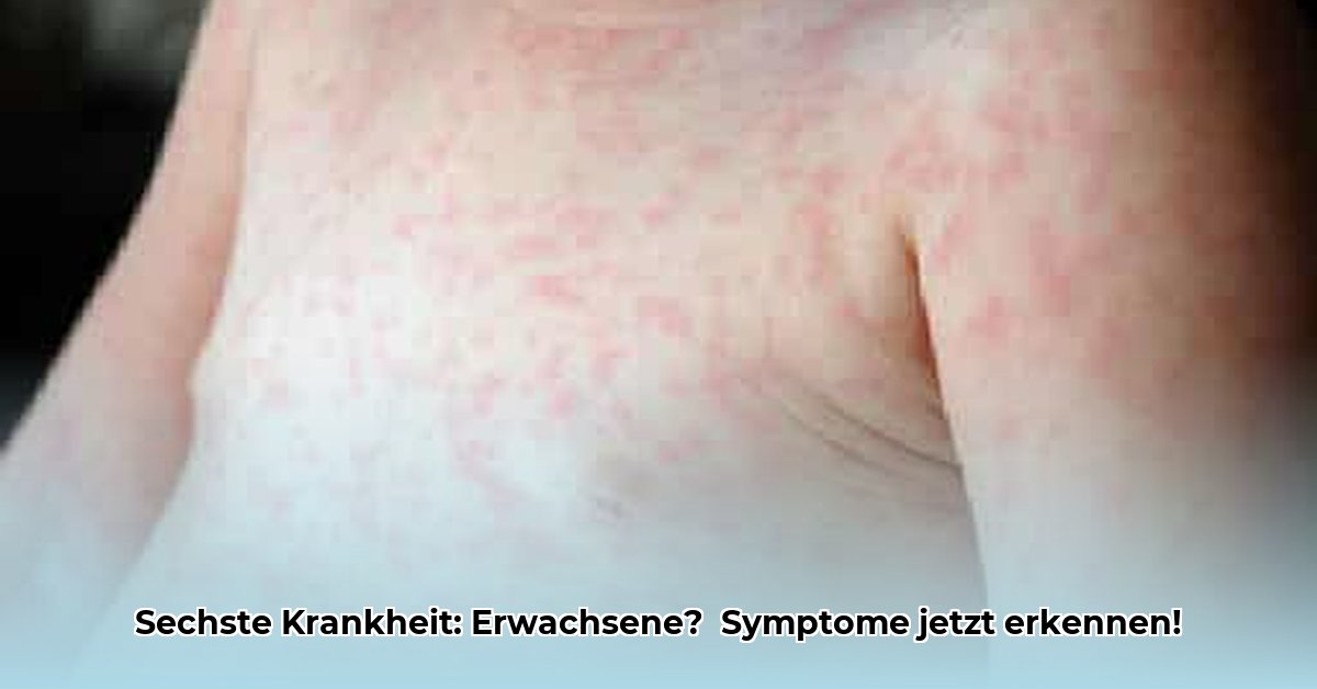 zesde-ziekte-volwassenen-symptomen